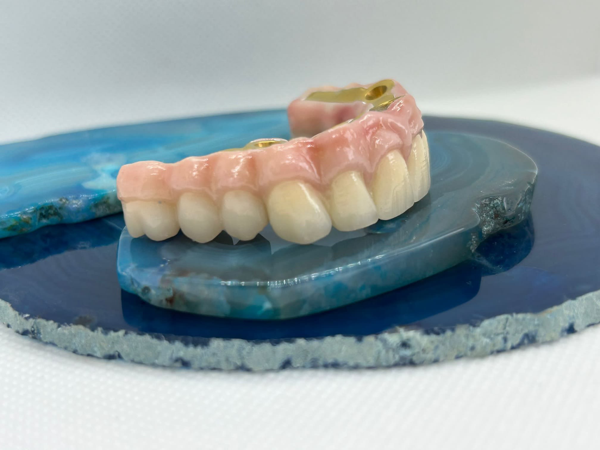 Images Steve Butler Dental Ceramics Ltd