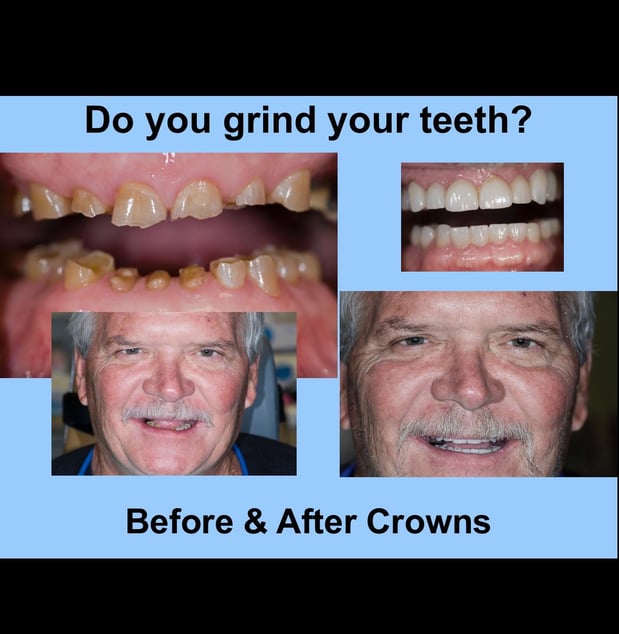 Images Decatur Smiles