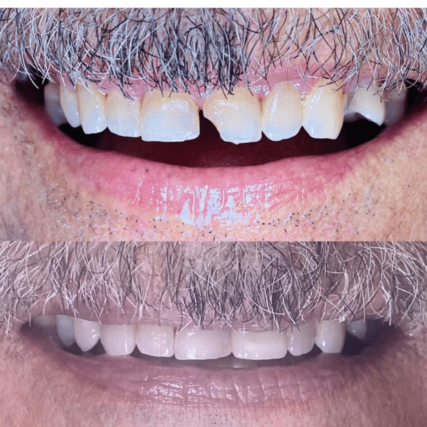 Images Selfie Smiles Dental Group