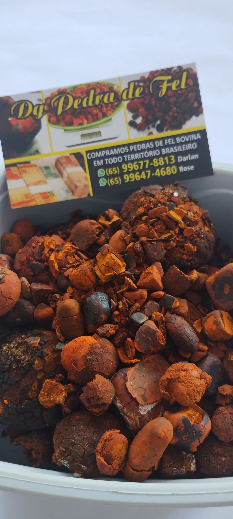 Images Dg pedras de fel bovinos