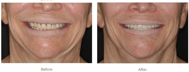 Images Aspen Ridge Dental