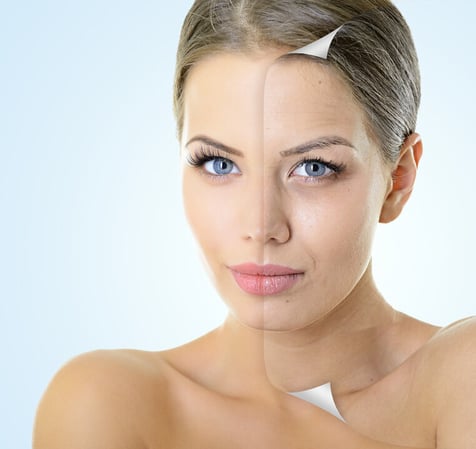 Bilder Soft Skin Hamburg  Laserstudio, Kryolipolyse, Microneedling, Anti Aging