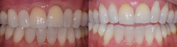 Images Mountainview Periodontics