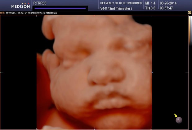 Images Heavenly 3D 4D Ultrasounds-Upland