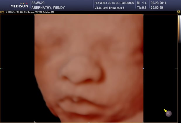 Images Heavenly 3D 4D Ultrasounds-Upland