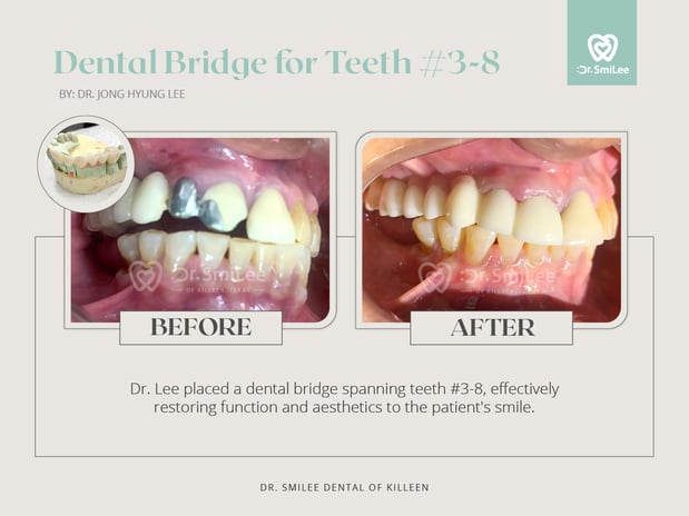 Images Dr Smilee Dental of Killeen, Family, Cosmetic, Implant, Medspa