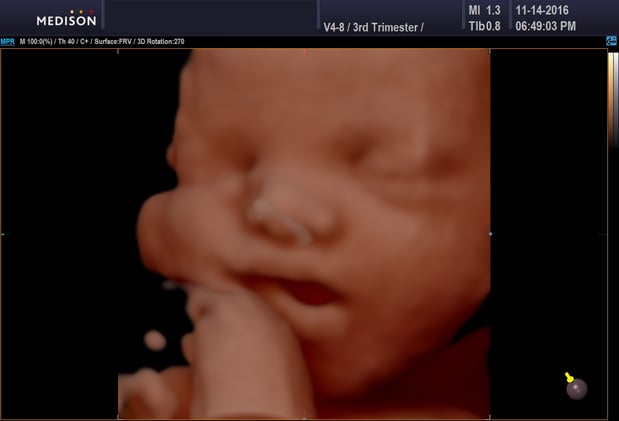 Images Heavenly 3D 4D Ultrasounds