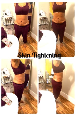 Images Queen Divas Body Sculpting