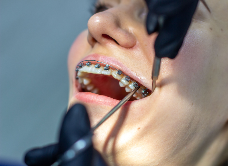 Images Croazia Dental Italia | Studio Dentistico | Vignola