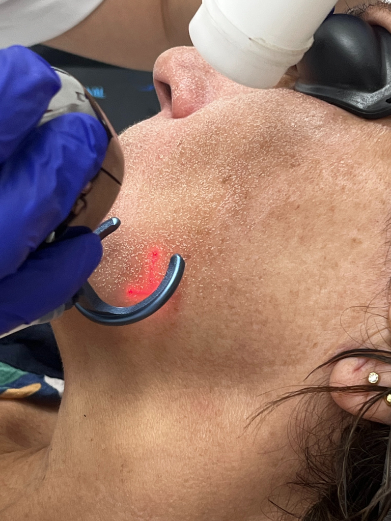 Images Dra. Silvia Solà. Medicina Estética y Láser