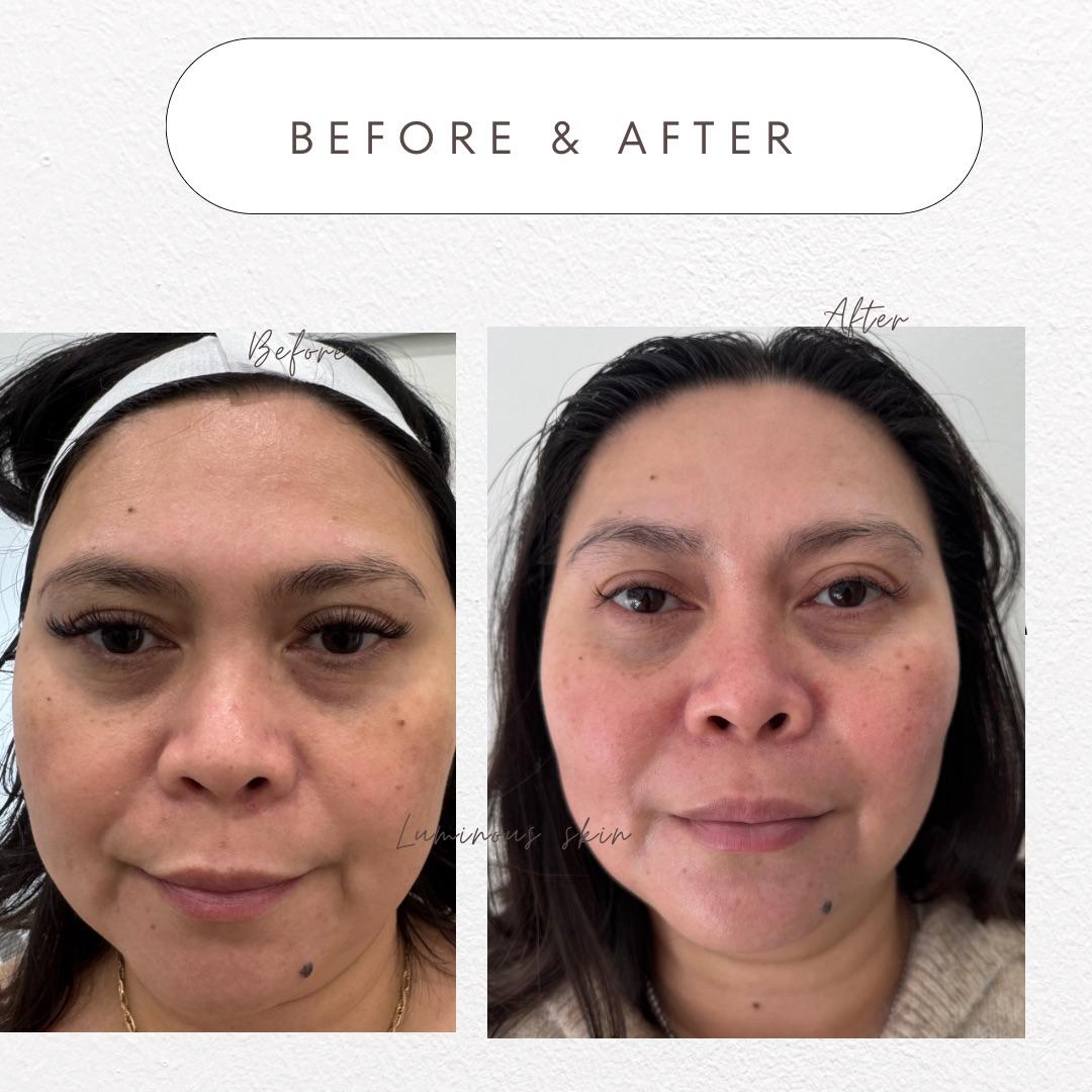 Images Luminous Skin