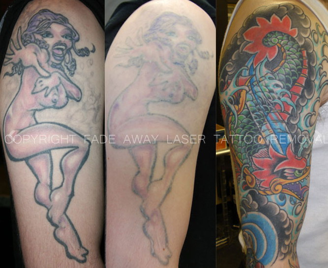 benchmark tattoo amp fade away laser tattoo removal in benchmark tattoo amp fade away laser tattoo removal in