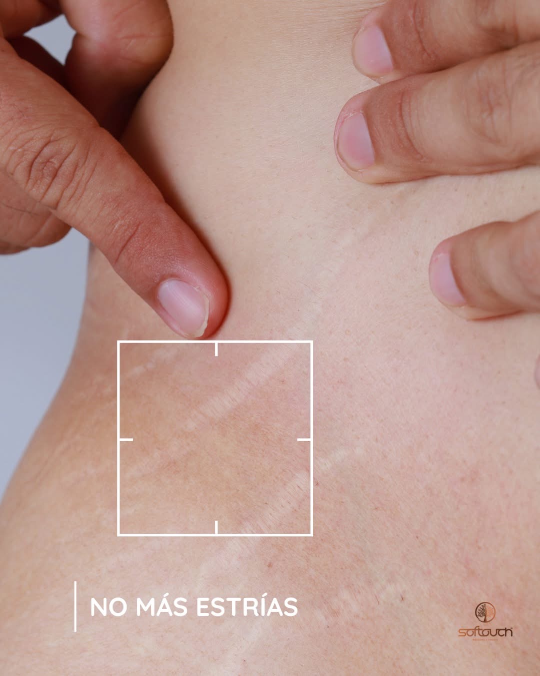 Images Softouch Medicina y Cirugía Estética