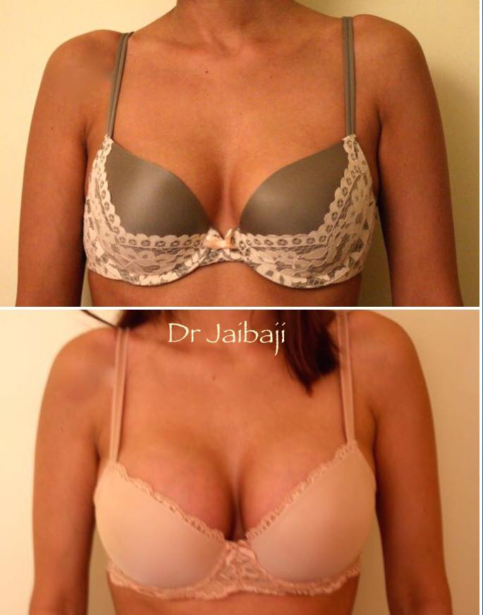 Jaibaji Plastic Surgery Photo