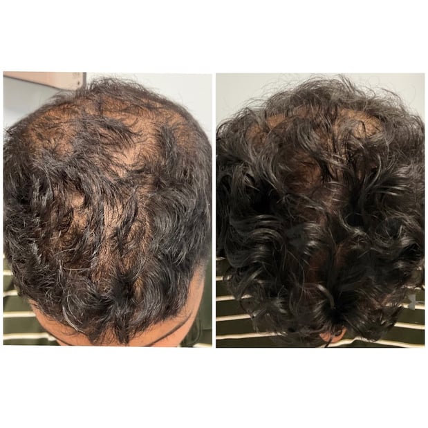Images DERMADUO Platelet Rich Plasma & Wellness Clinic