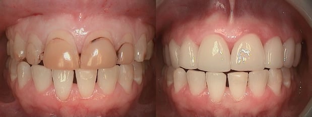 Images Complete Dental Health