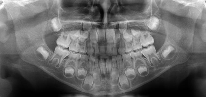 Images Dentalrad