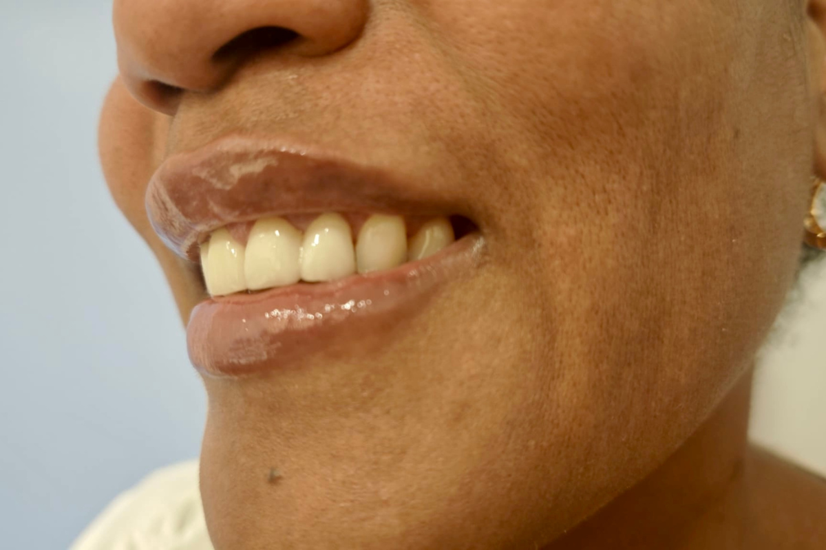 Images Dra. Silvia Solà. Medicina Estética y Láser