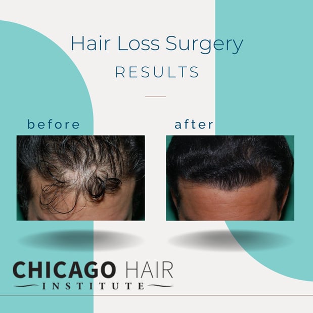 Images Chicago Hair Institute