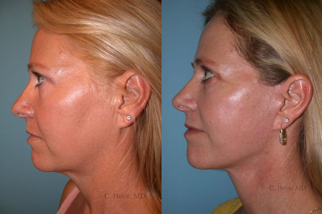 Images Hove Center for Facial Plastic Surgery