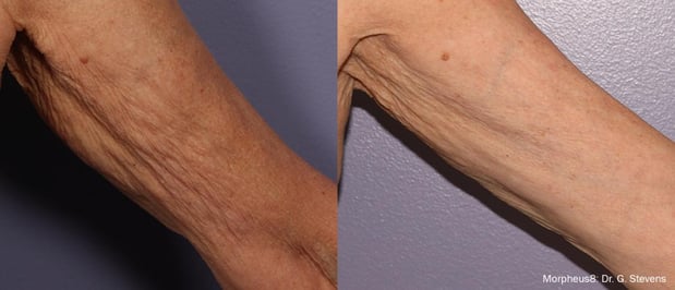 Images EliteBio: Hormone and Aesthetic Solutions