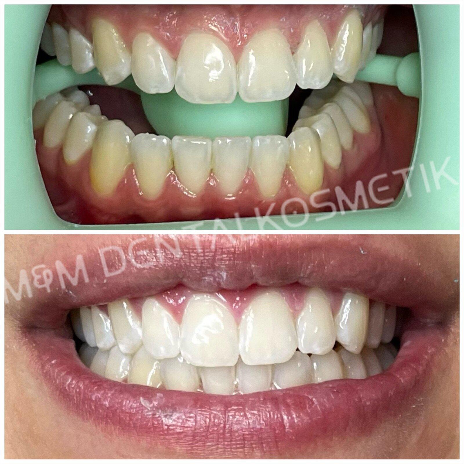Bilder M&M Dentalkosmetik