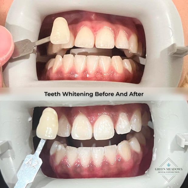 Images Green Meadows Dental Connection