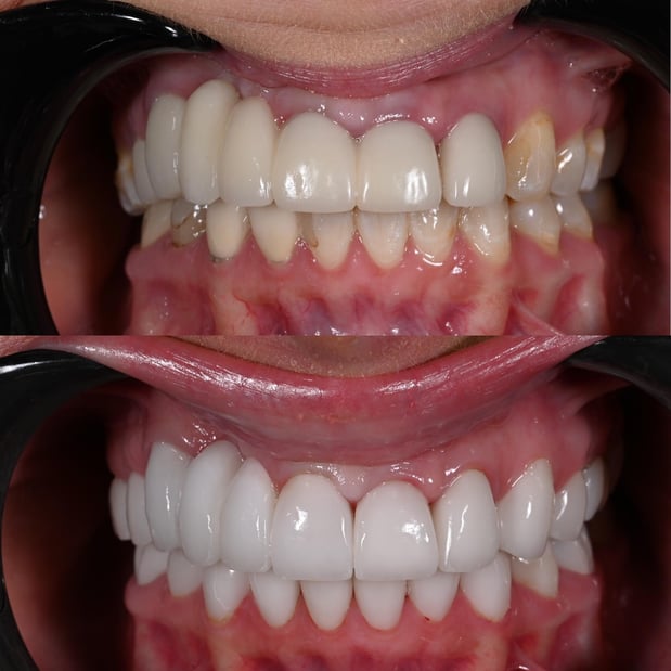 Images Nashville Wisdom Teeth and Implant Solutions