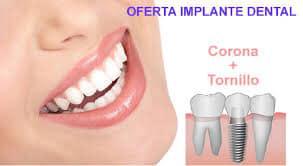 Images Clínica Dental Gloria