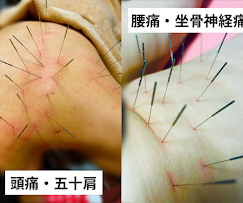 Images 鍼処KAKUREGA
