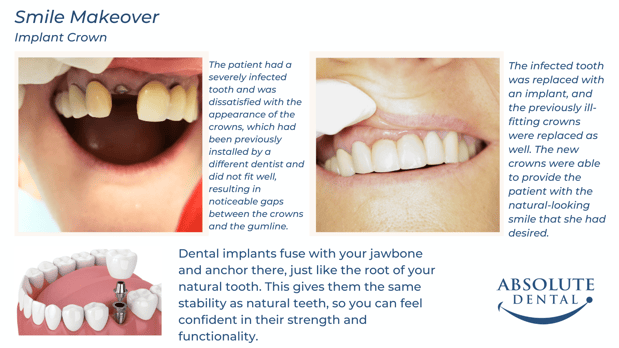 Images Absolute Dental