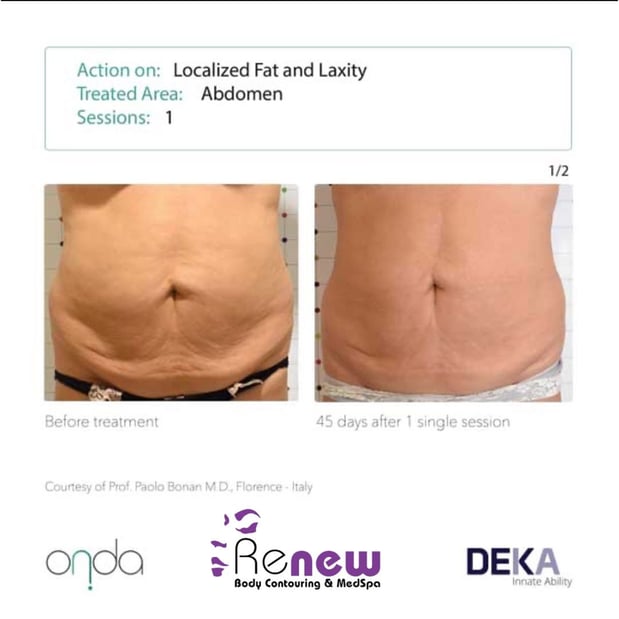 Images Renew Body Contouring & MedSpa