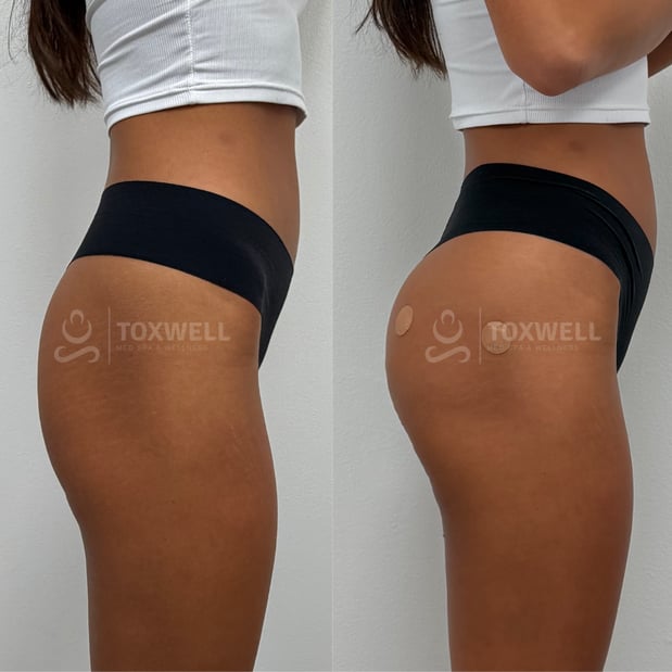 Images Toxwell Med Spa and Wellness