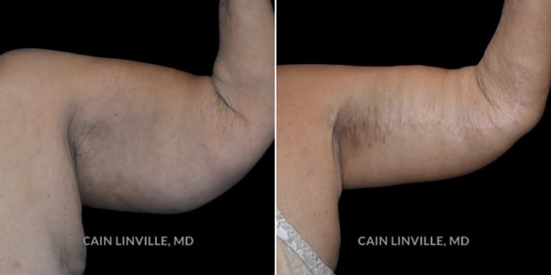 Images Linville Plastic Surgery