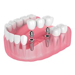 Borstal Gate Dental Surgery 9