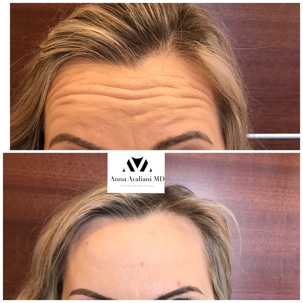 Images Anna Avaliani MD Cosmetic & Laser Surgery