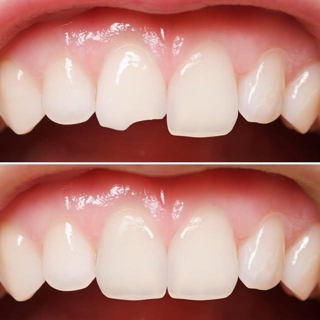 Images Smiles By Eddie: Dr. Edmond Ahdoot DDS