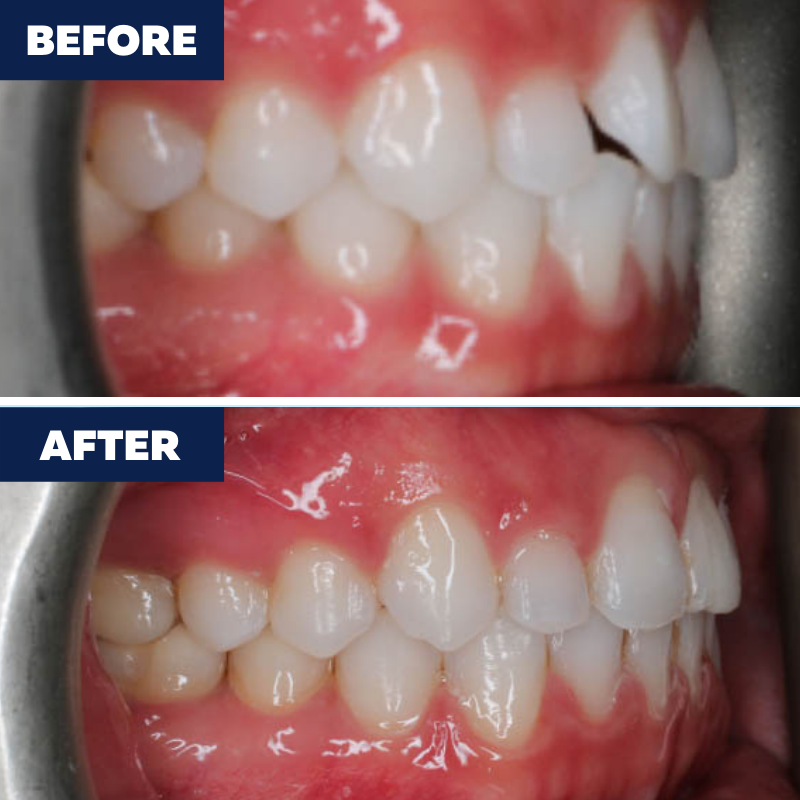 Images Orthodontics of Carson