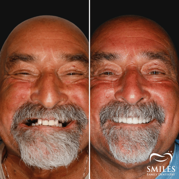 Images Brunswick Smiles Family Dentistry Implant, Oral Surgery, and Cosmetic Dentist