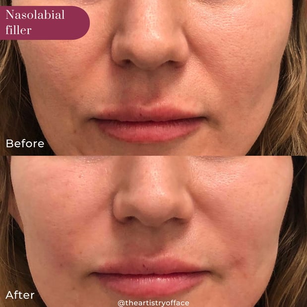Images Artistry Of Face - Loudonville