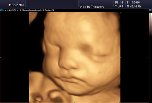 Images Heavenly 3D 4D Ultrasounds