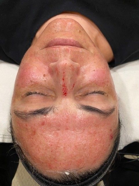 Images NP Aesthetics Las Vegas