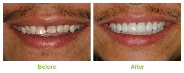 Images Salt Lake Dental Care - Clint Blackwood DDS