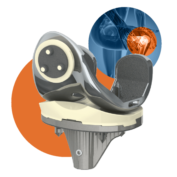 Images Optimotion Implants