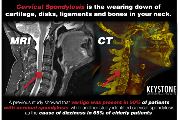 Images Keystone Upper Cervical Spine Clinic