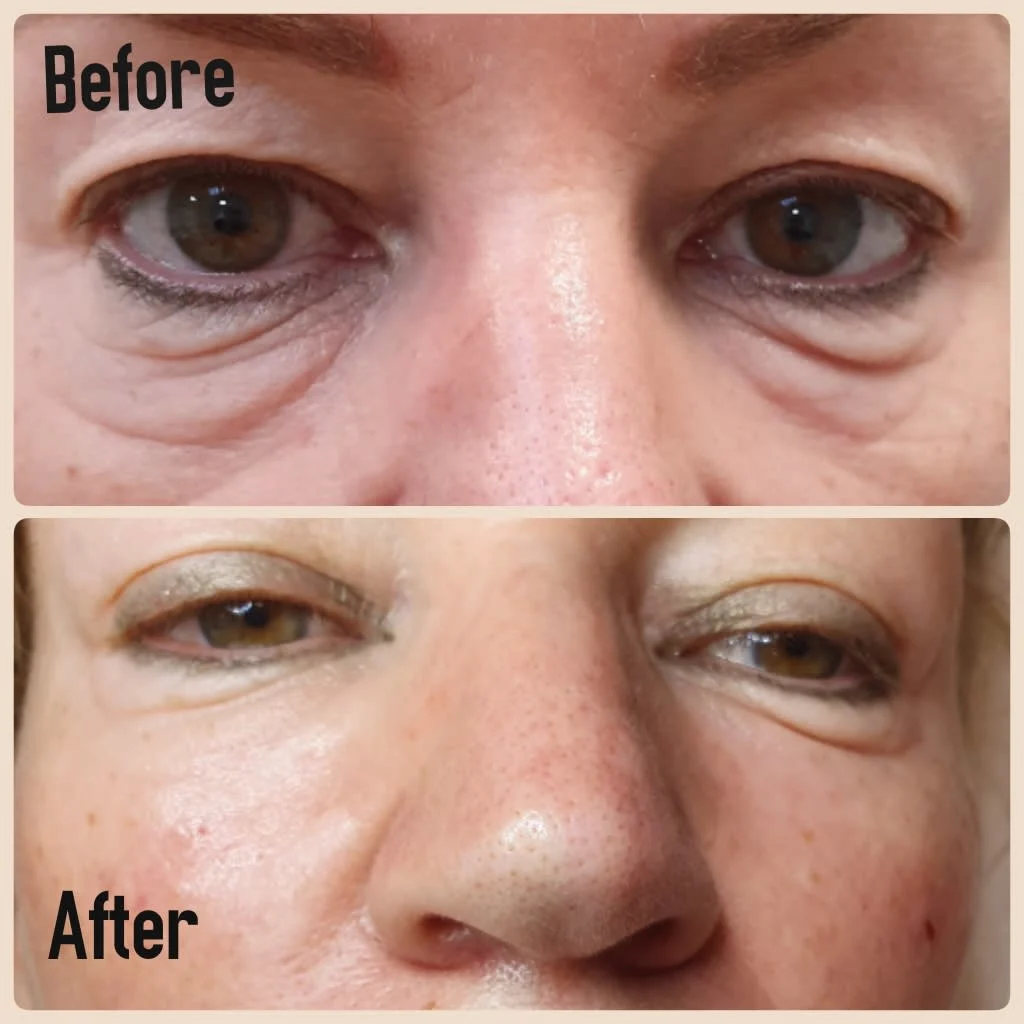 Images Lincoln Aesthetic