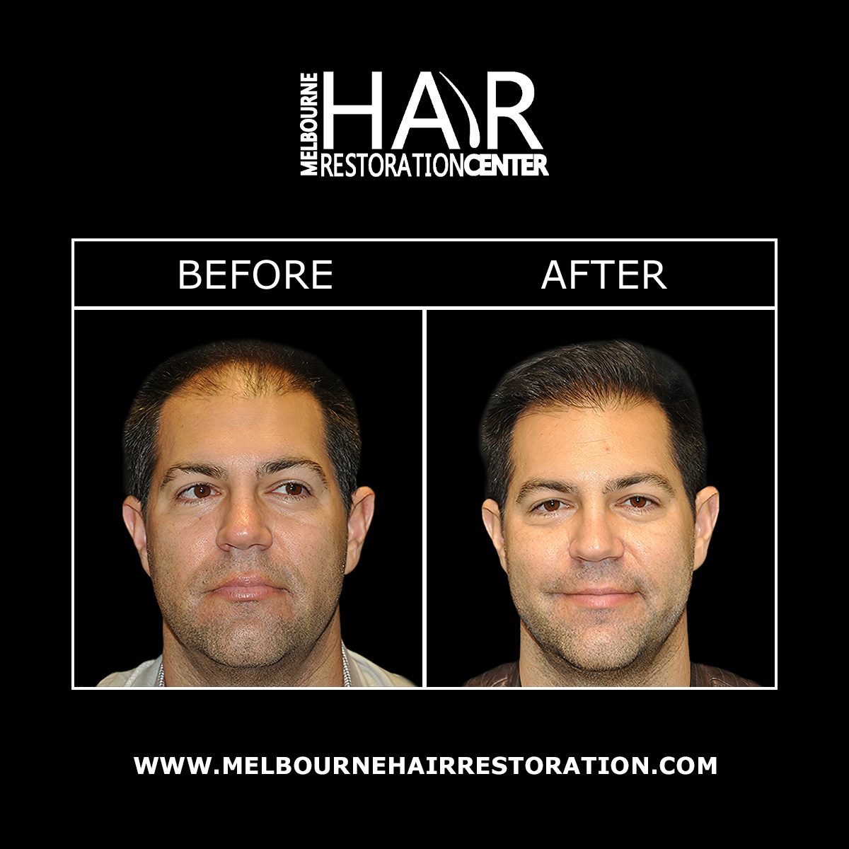 Melbourne Hair Restoration Center Image