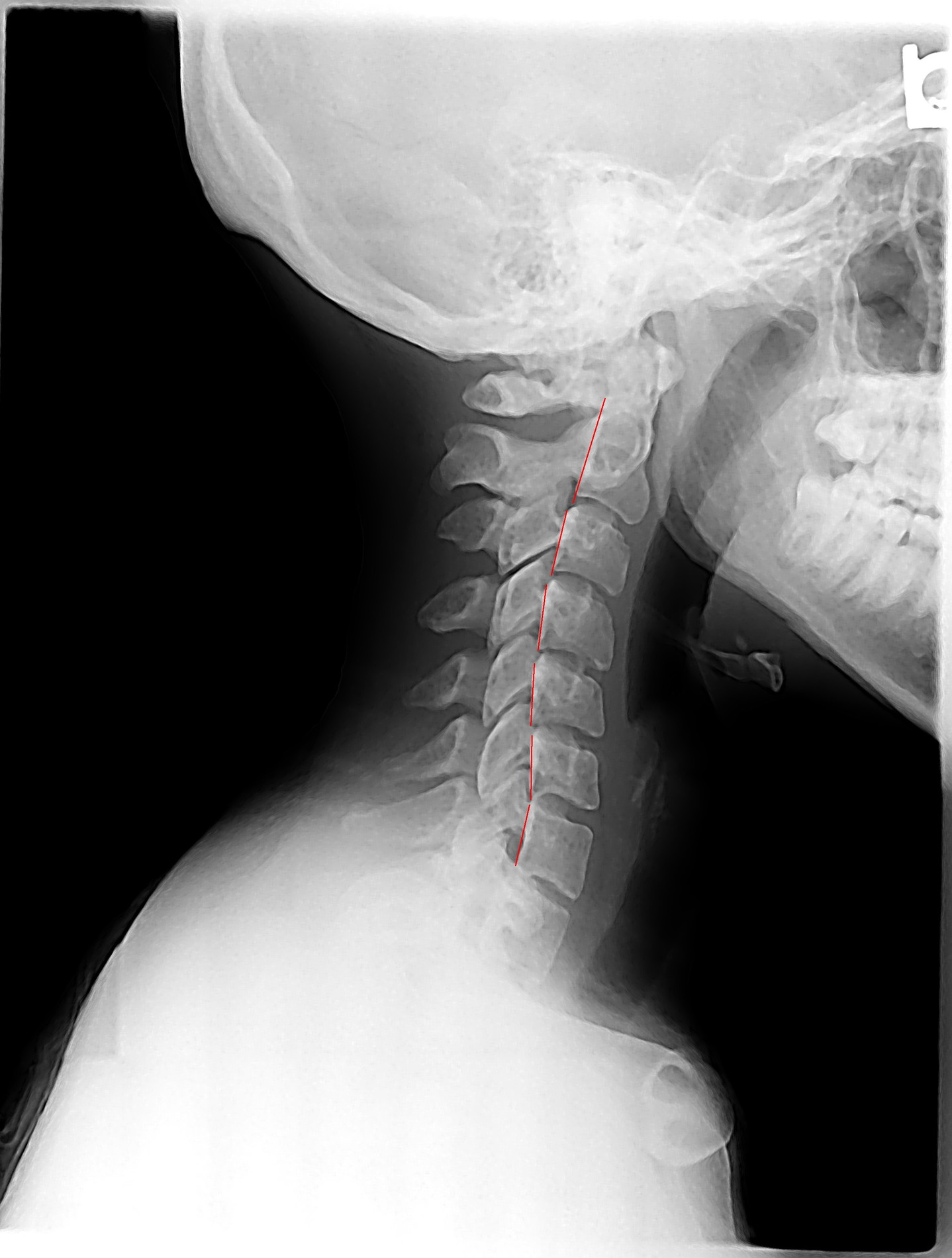 Images Fiorini Chiropractic Center, P.A.