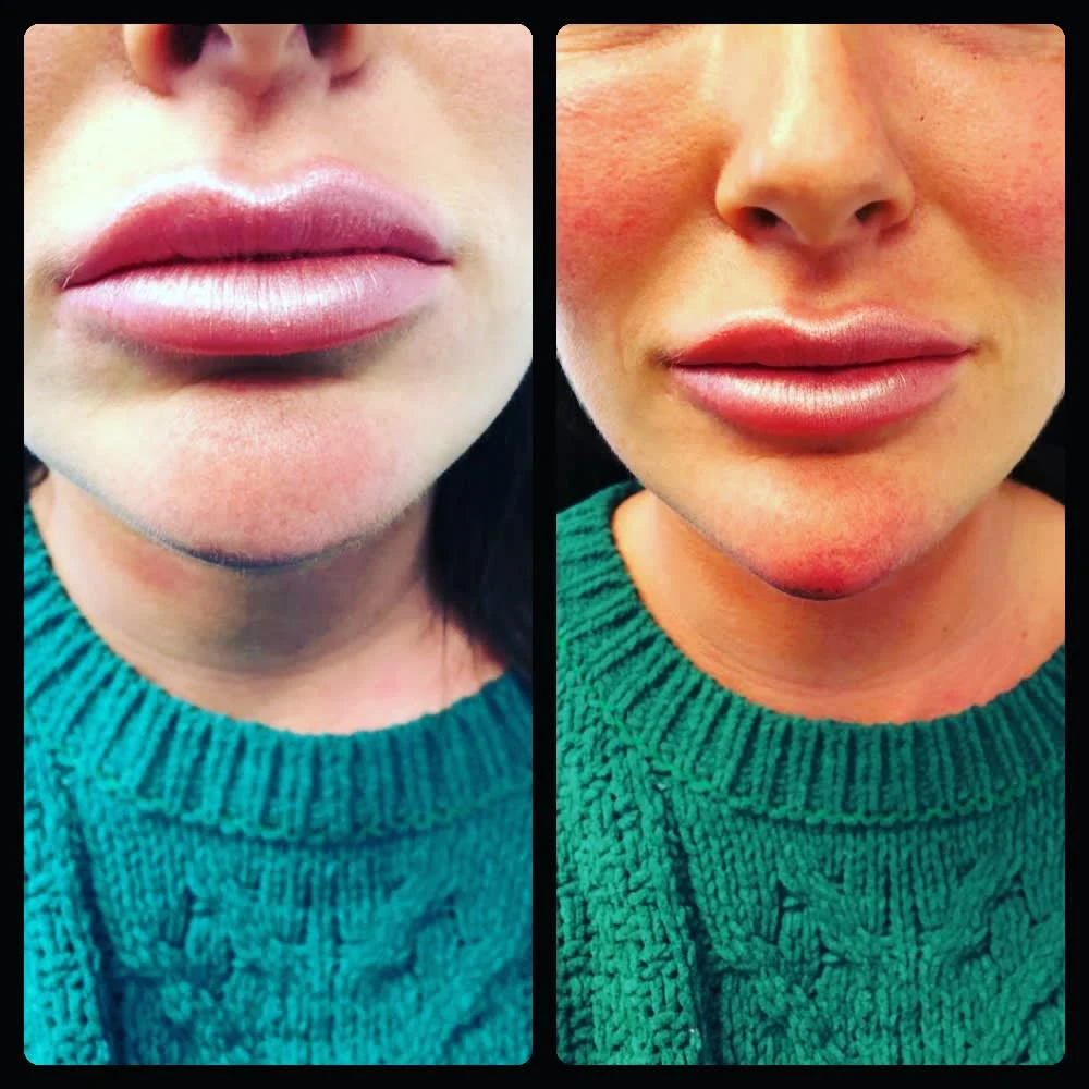 Images Lincoln Aesthetic