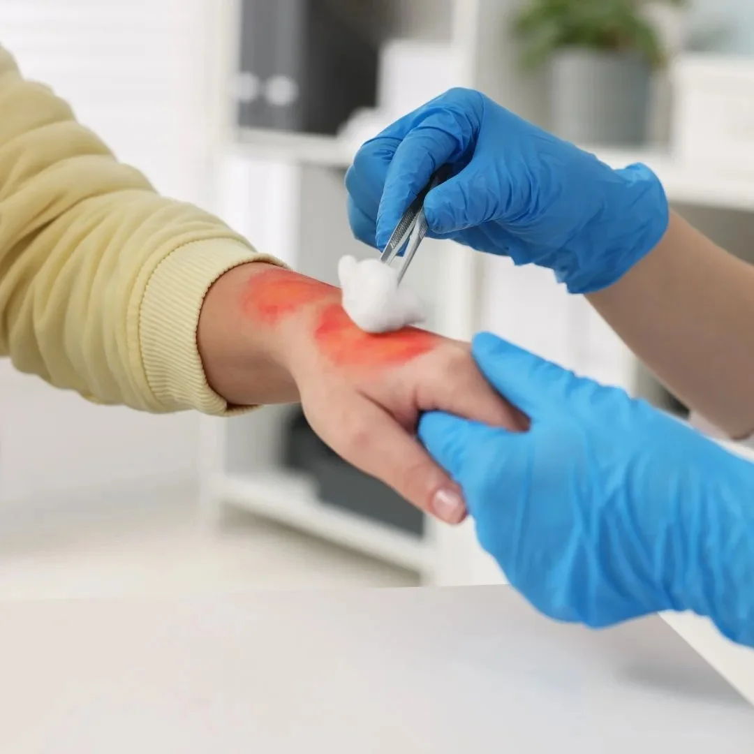 Minor Wounds & Burns – Care Without the ER